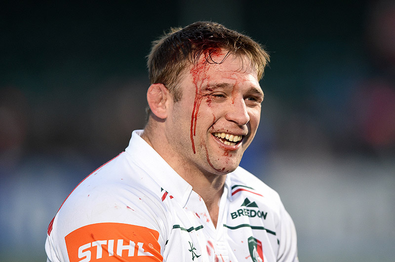 A bloodied Tom Youngs of Leicester Tigers looks on after beating Saracens